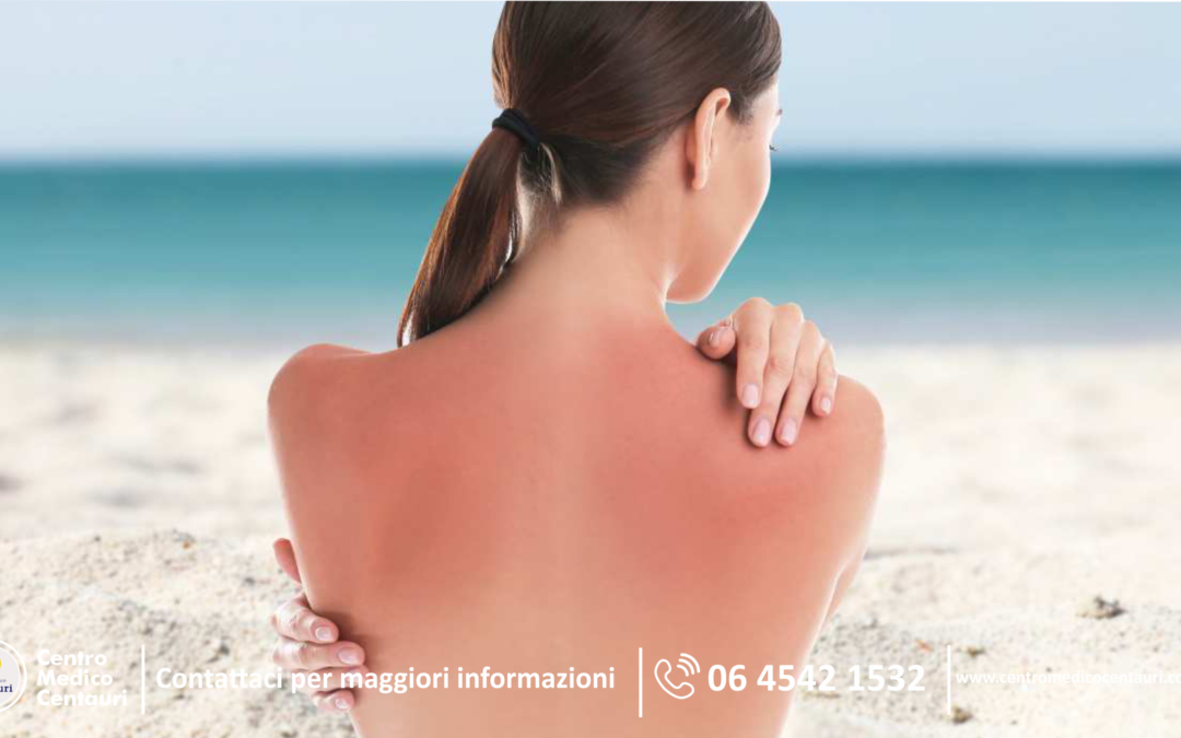 𝘈𝘣𝘣𝘳𝘰𝘯𝘻𝘢𝘳𝘴𝘪 𝘪𝘯 𝘮𝘢𝘯𝘪𝘦𝘳𝘢 𝘴𝘪𝘤𝘶𝘳𝘢 🏖️👙𝘊𝘰𝘯 𝘭’𝘢𝘳𝘳𝘪𝘷𝘰 𝘥𝘦𝘭𝘭𝘦 𝘷𝘢𝘤𝘢𝘯𝘻𝘦 𝘯𝘰𝘯 𝘴𝘤𝘰𝘳𝘥𝘢𝘳𝘵𝘪 𝘥𝘦𝘭𝘭𝘢 𝘤𝘳𝘦𝘮𝘢𝘴𝘰𝘭𝘢𝘳𝘦 ☀️  👇