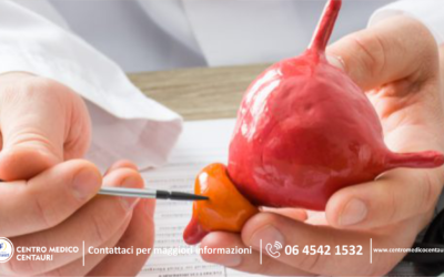 Tumore della prostata: tra le possibili cause câĂš lâinfiammazione cronica