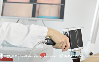 Melanoma e tumori della pelle